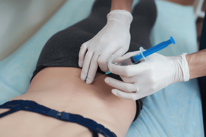 blockade sa lumbar osteochondrosis